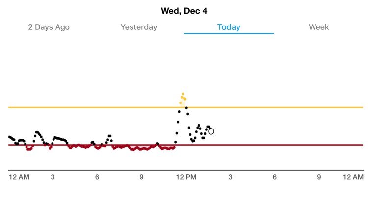 Dexcom Glucose Program App screenshot-3