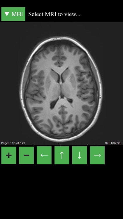 MRI Viewer