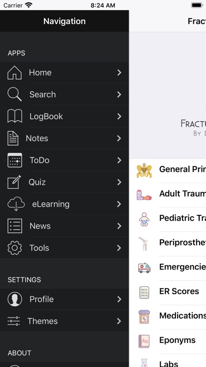 Fracture Classification HD