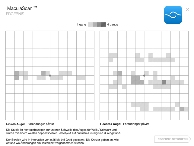 MaculaScan (DE)(圖9)-速報App