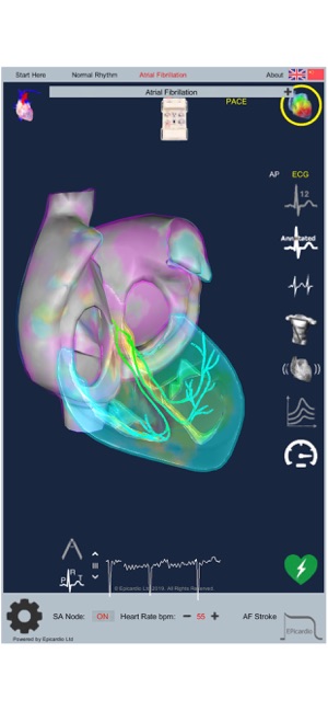 Intelligent Heart Sim AFib(圖6)-速報App