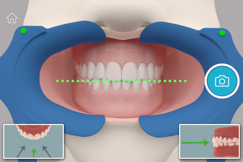 DentalMonitoring screenshot 3