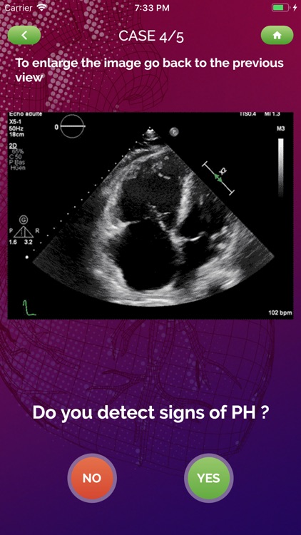 EchoRight screenshot-3