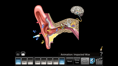 How to cancel & delete Ear Disorders: Outer Middle from iphone & ipad 4