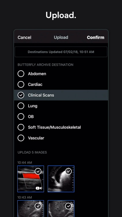 Butterfly iQ — Ultrasound