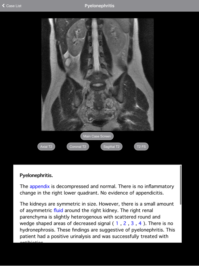 Pregnant Appendicitis(圖5)-速報App