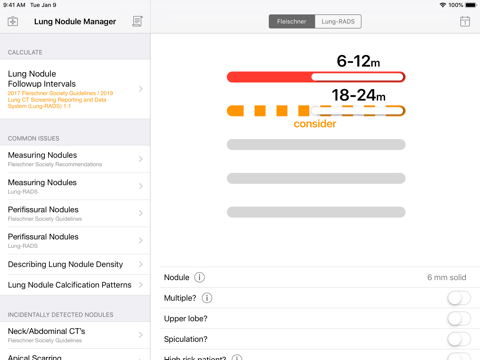 Lung Nodule Followup Manager - náhled