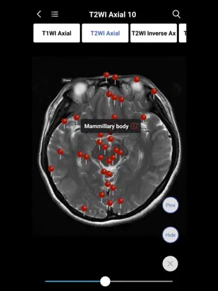 Captura de Pantalla 3 MedImaging-Radiology Made Easy iphone