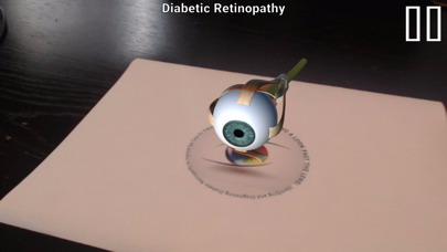 Diabetic Retinopathy AR screenshot 2