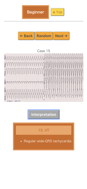 Pocket ECG(圖3)-速報App