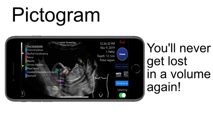 Scanbooster Ultrasound Sim screenshot-3