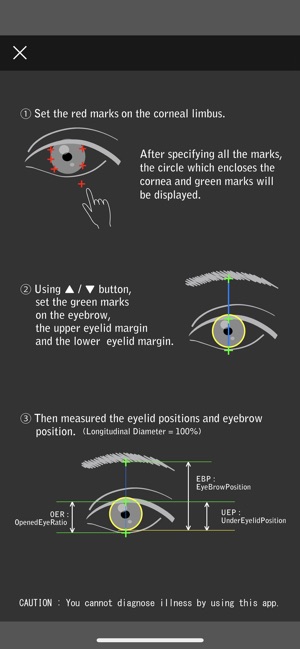 Eyelid(圖4)-速報App