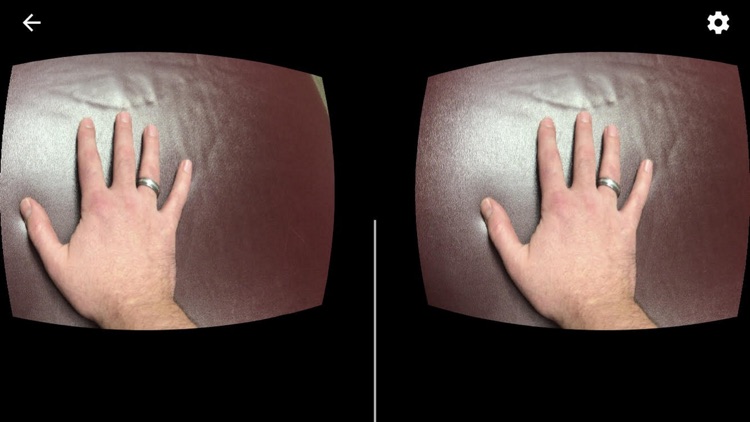 Mirror Box: CRPS & RSD, Stroke