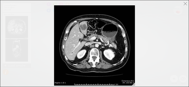 LIVER-NOTE.Edu(圖2)-速報App