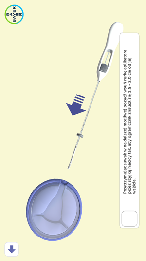 IUS Insertion(圖6)-速報App