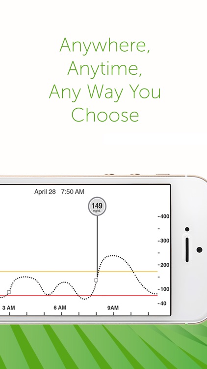 Dexcom G5 Mobile