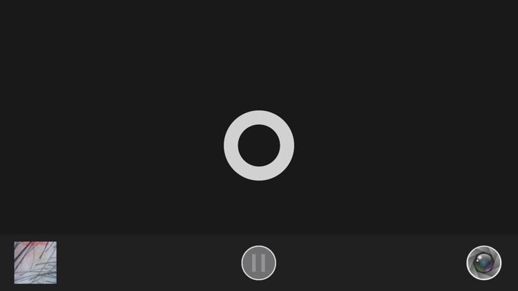 头皮毛发检测-新生活