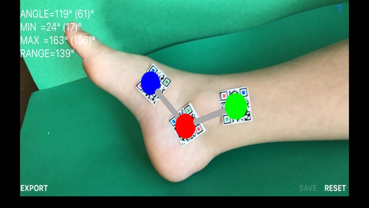 DynamicGoniometerAR