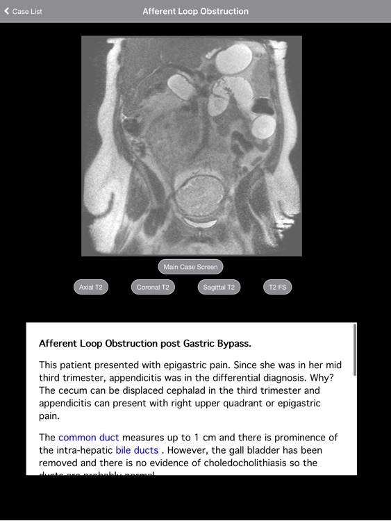 Pregnant Appendicitis screenshot-3