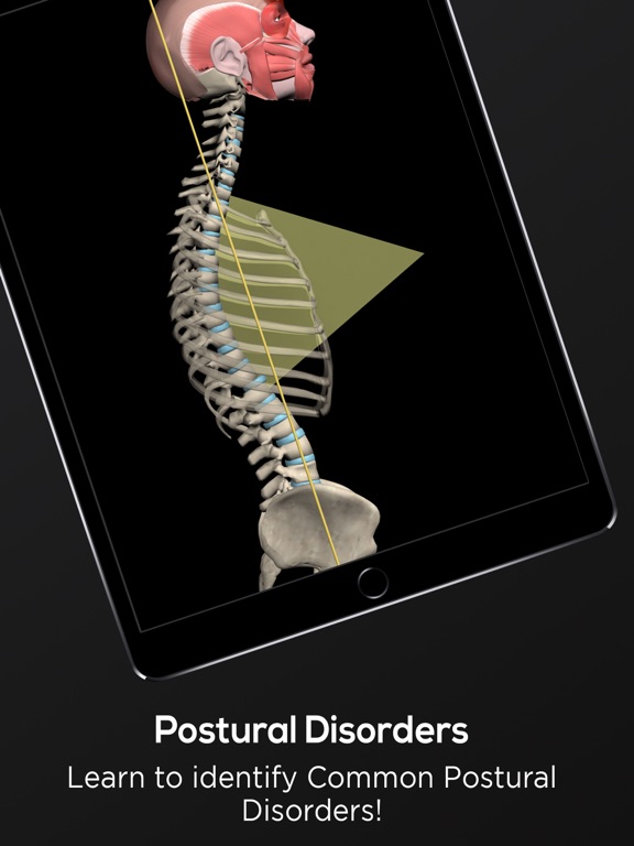 Posture by Muscle & Motion screenshot 4