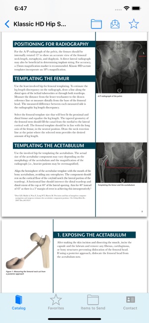 Total Joint Orthopedics(圖3)-速報App