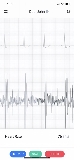 Eko: Digital Stethoscope + ECG(圖4)-速報App