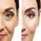 Wrinkles are creases, folds, or ridges in the skin