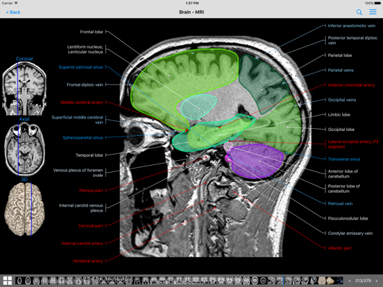 IMAIOS e-Anatomy screenshot