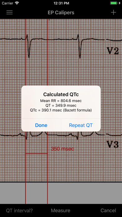 EP Calipers Screenshot 4