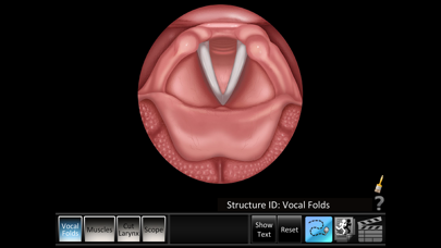 How to cancel & delete Vocal Folds ID from iphone & ipad 1