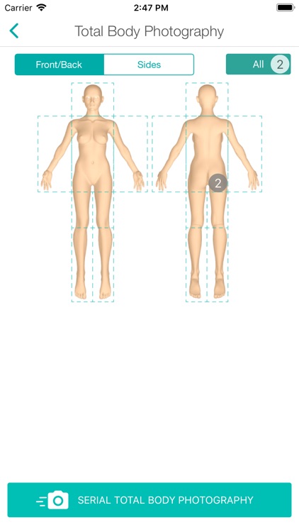 MoleScope™ screenshot-4