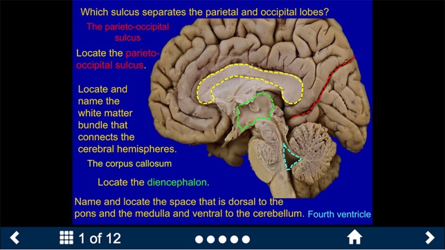 Neuroanatomy Lite - SecondLook(圖2)-速報App