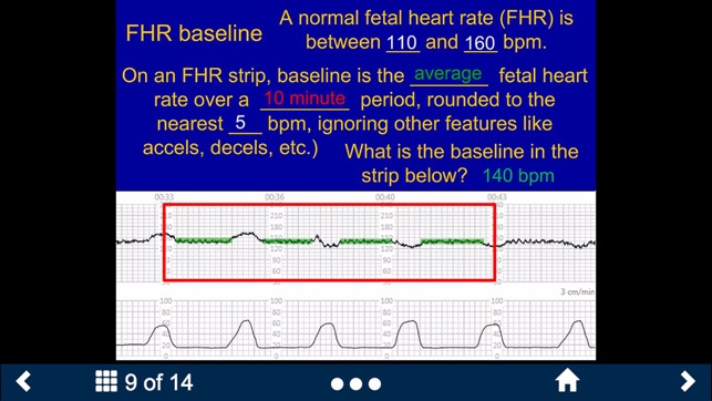 Fetal Heart Rate - SecondLook(圖3)-速報App