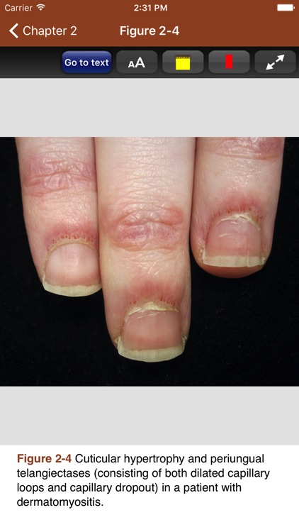 Derm Signs Systemic Disease 5E screenshot-3