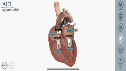 3D Heart Education screenshot 2