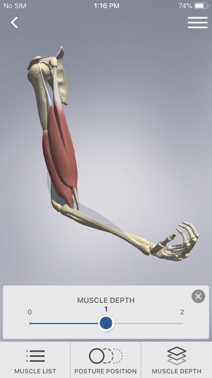 3D Spasticity