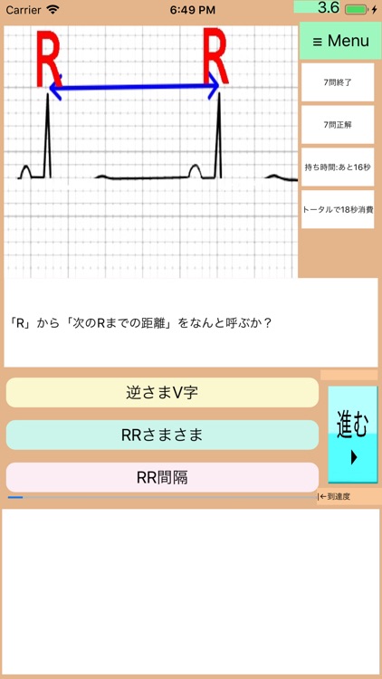 なんちゃって心電図全集(総集編):Drアニメ150問 screenshot-8