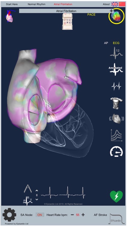 Intelligent Heart Sim AFib screenshot-9