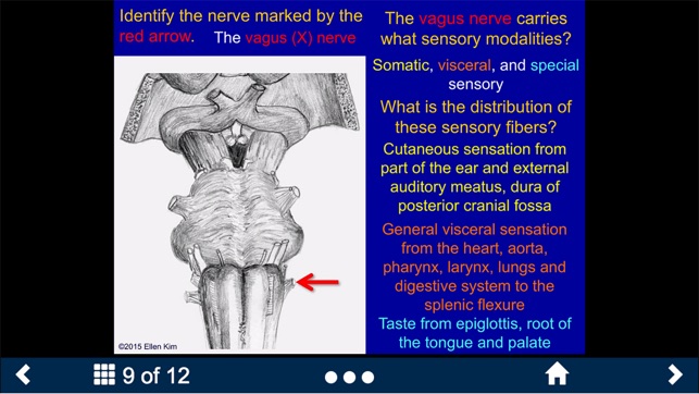 Neuroanatomy - SecondLook(圖4)-速報App