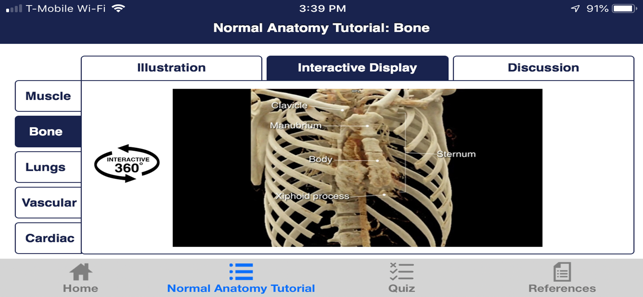 CTisus Chest Atlas 3D CRT(圖4)-速報App