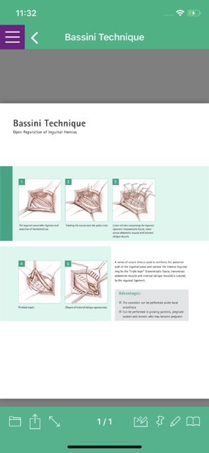 B. Braun Abdominal Wall Health(圖4)-速報App