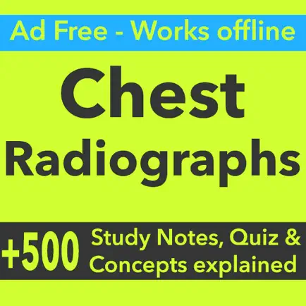 Chest Radiographs Exam Prep Читы