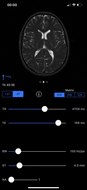 MRIcontrast Pro(圖5)-速報App