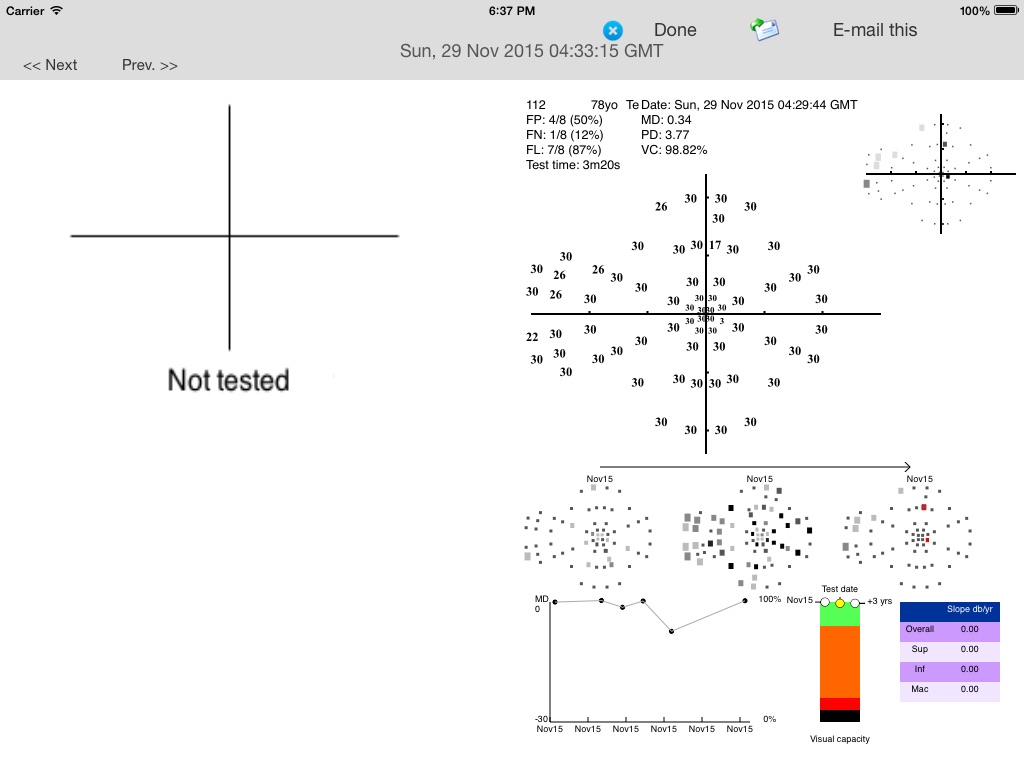 MRF Glaucoma Lite screenshot 4