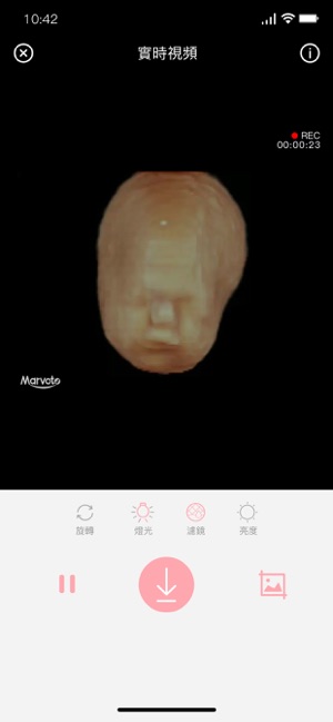 胎兒相機(圖3)-速報App