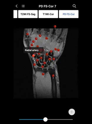 Captura de Pantalla 7 MedImaging-Radiology Made Easy iphone
