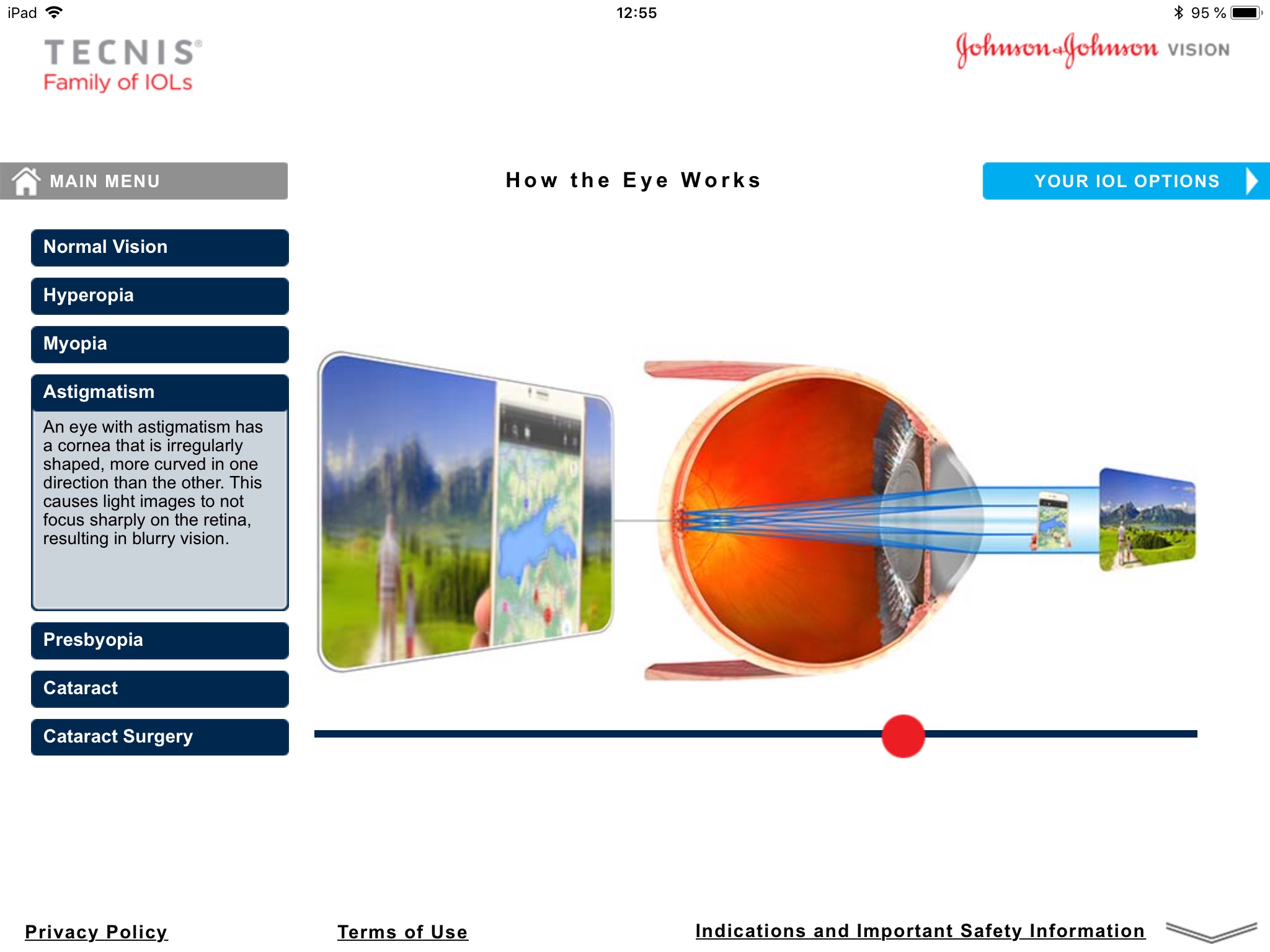 TECNIS® Vision Simulator screenshot 2
