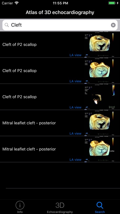 CARDIO3® 3D Echocardiography screenshot-3