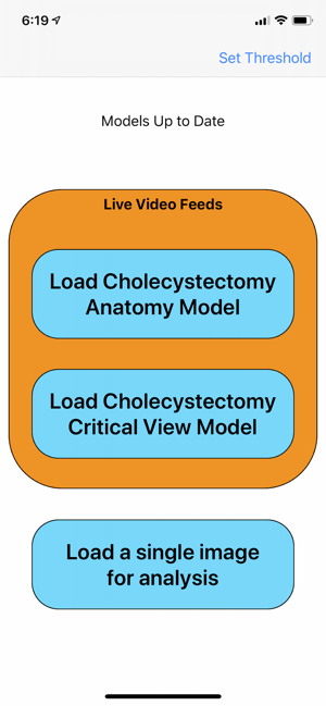 Cholecystectomy AI