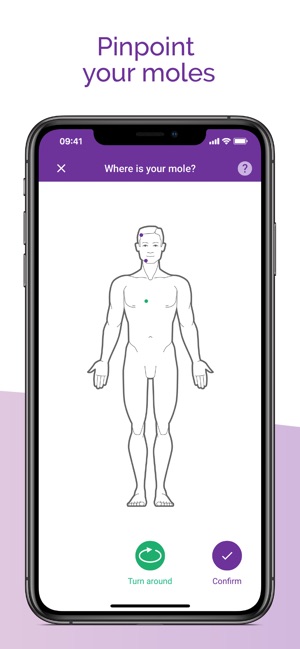 Miiskin - Melanoma Skin Cancer(圖4)-速報App